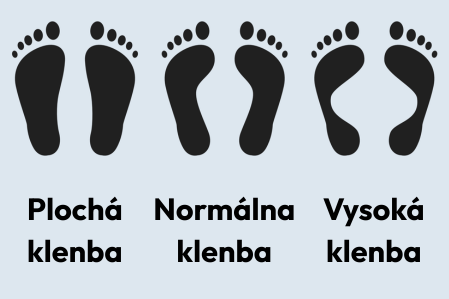 Typy klenby chodidla